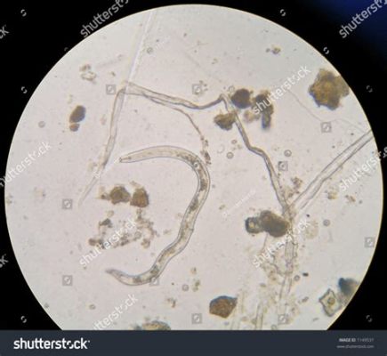  Urosporidium! Một Ký Sinh Trùng Vô Hình Giữ Bí Mật Trong Thể Giới Thủy Tinh